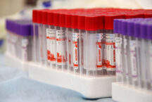 Самая сильная группа крови: первая группа защищает от рака и деменции