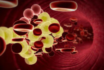 Холестерин и здоровье сердца: что нужно знать казахстанцам